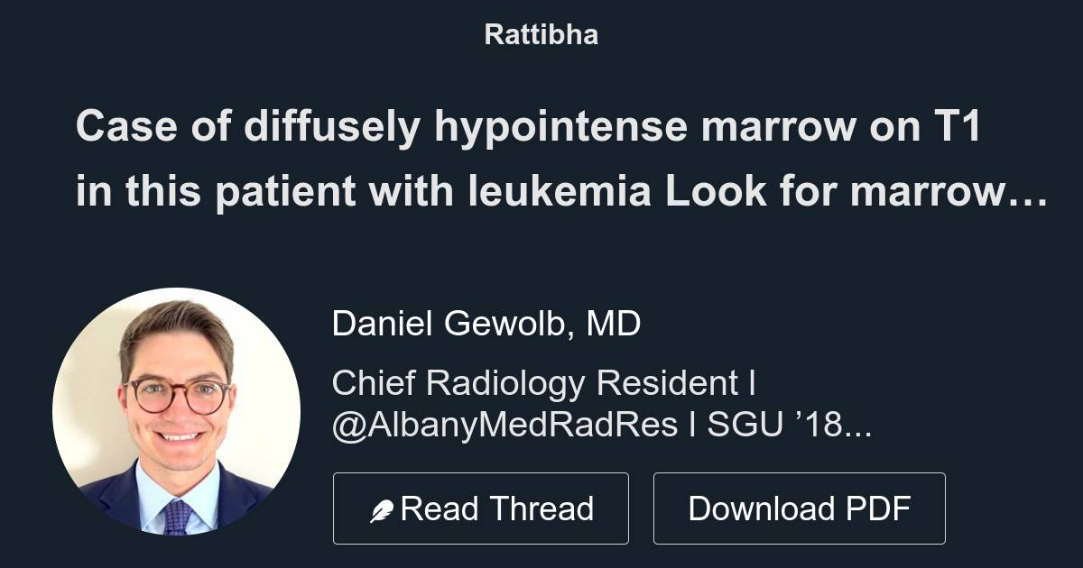 Case of diffusely hypointense marrow on T1 in this patient with ...