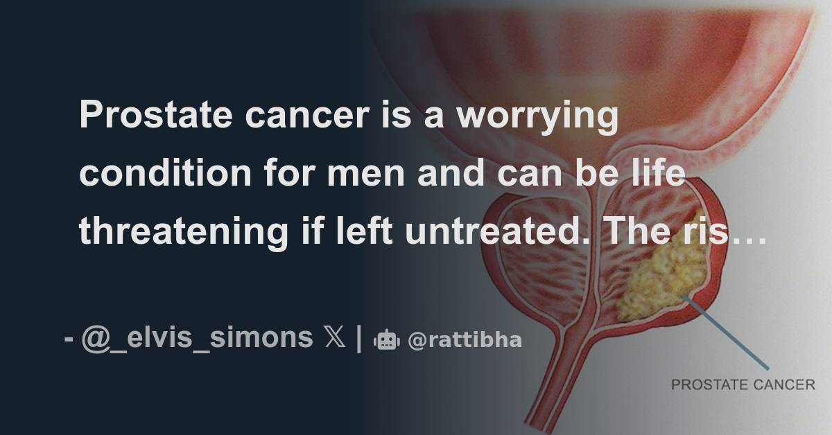 Prostate cancer is a worrying condition for men and can be life ...