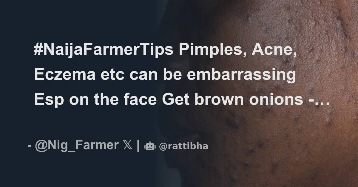 NaijaFarmerTips Pimples, Acne, Eczema etc can be embarrassing Esp on