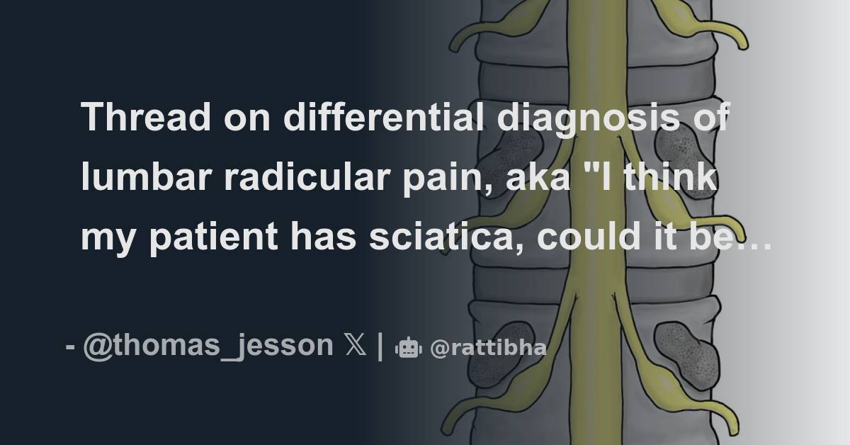 Thread on differential diagnosis of lumbar radicular pain, aka "I think