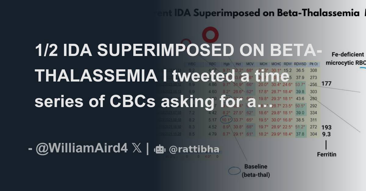 1/2 IDA SUPERIMPOSED ON BETA-THALASSEMIA I Tweeted A Time Series Of ...