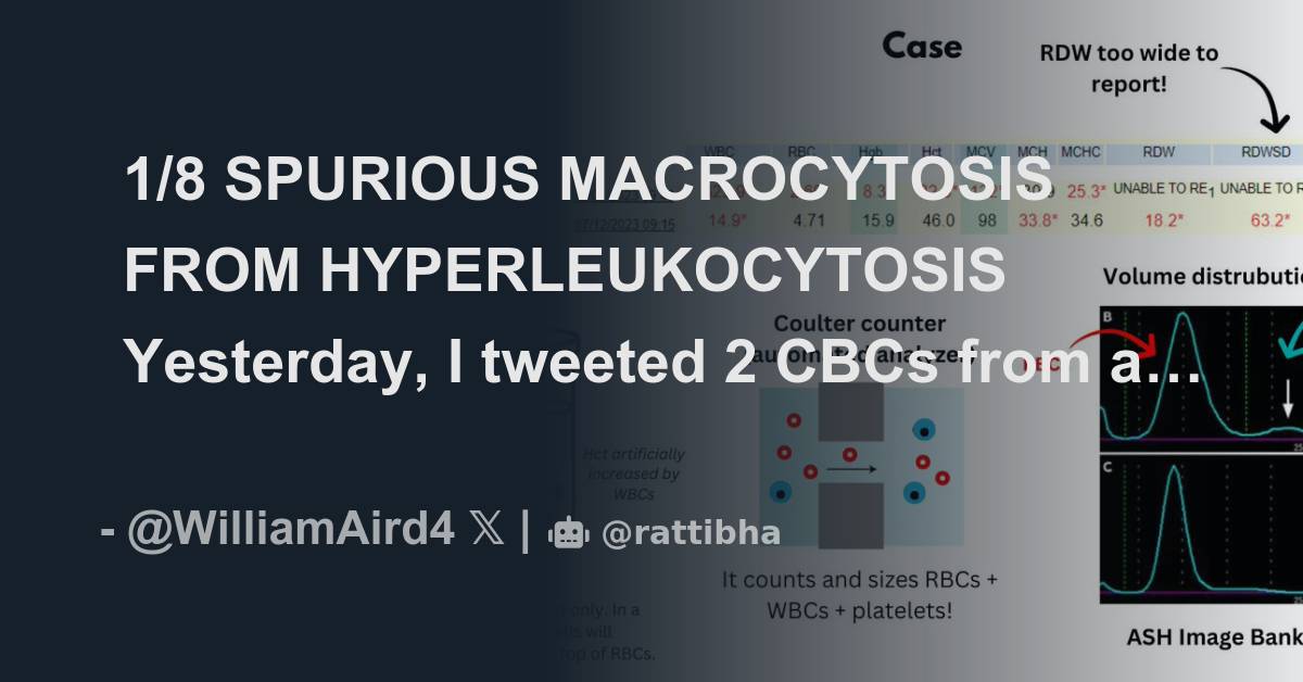 1/8 SPURIOUS MACROCYTOSIS FROM HYPERLEUKOCYTOSIS Yesterday, I Tweeted 2 ...