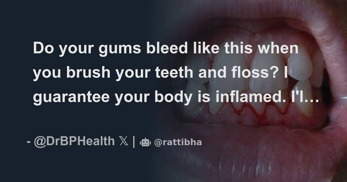Do your gums bleed like this when you brush your teeth and floss? I