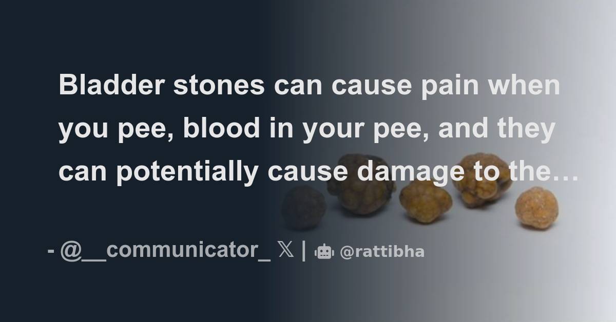 bladder-stones-can-cause-pain-when-you-pee-blood-in-your-pee-and-they